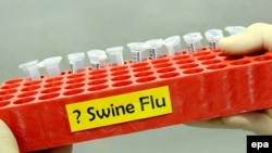 Australia -- Vials to be tested for the 'Swine Flu' Influenza Virus in Brisbane, 29Apr2009